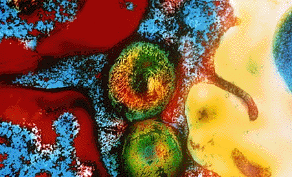Imagen: Microfotografía electrónica de transmisión a color (TEM) de un corte a través de la membrana de una célula humana mostrando dos mitocondrias (Fotografía cortesía de BSIP Meullemiestre / SPL).